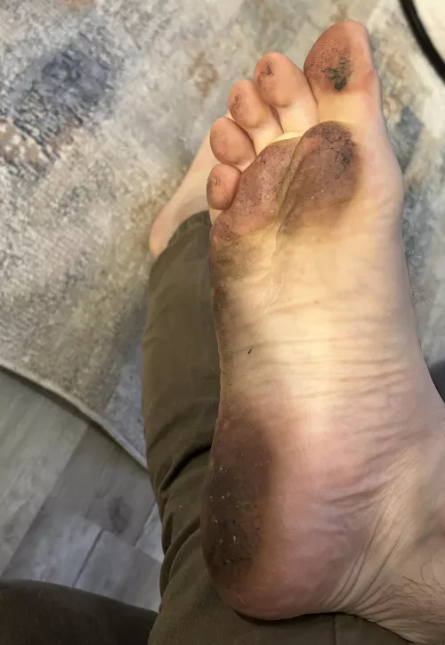 I bet you need to use your teetg