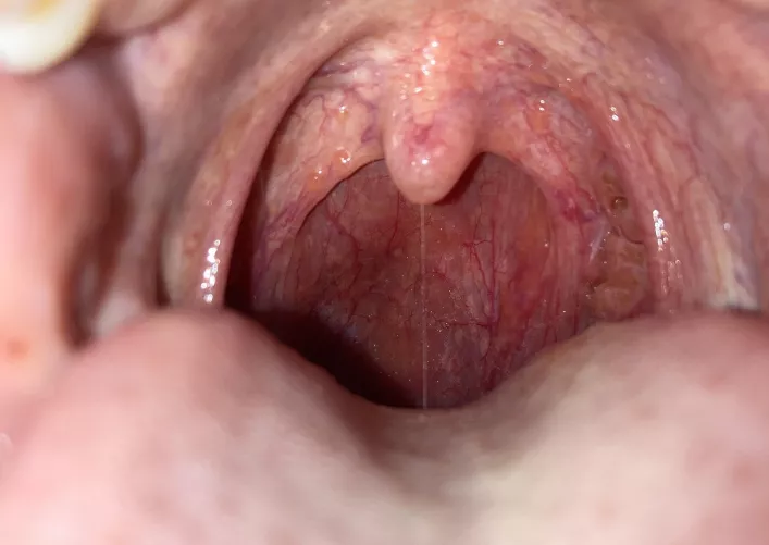 Is this strep throat? Could it be something else, and is it worth going to the doctors for?