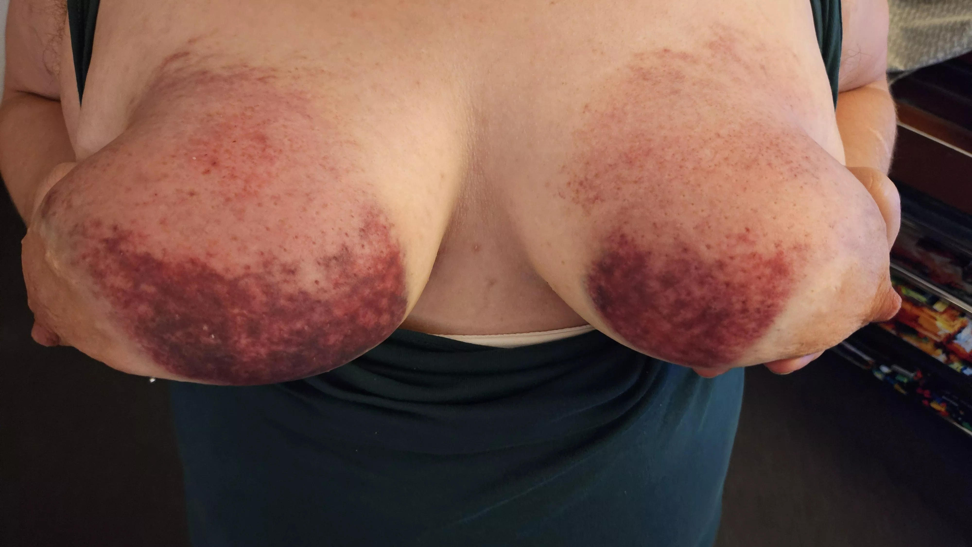 More bruises on my punching bag slave