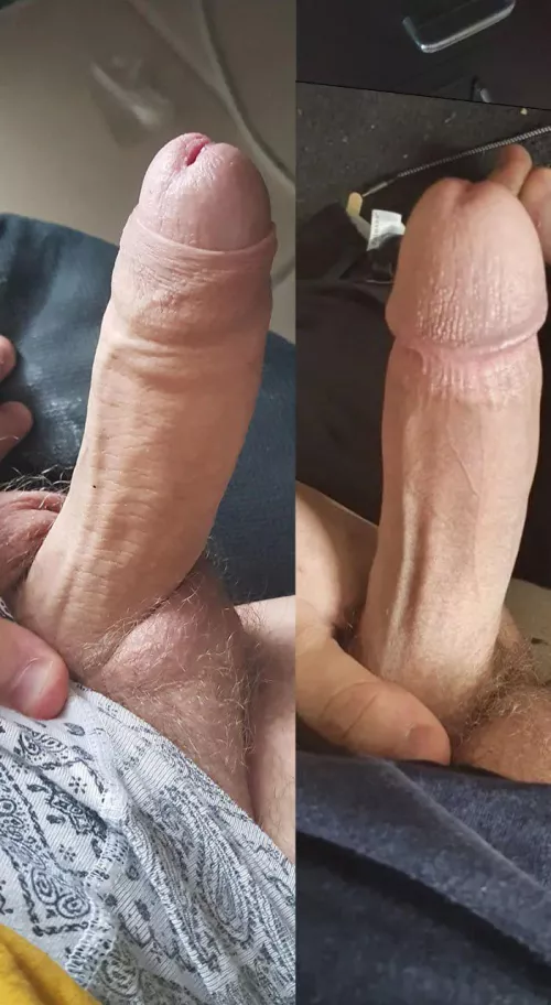 My former real cock on its last day vs my mutilated dick