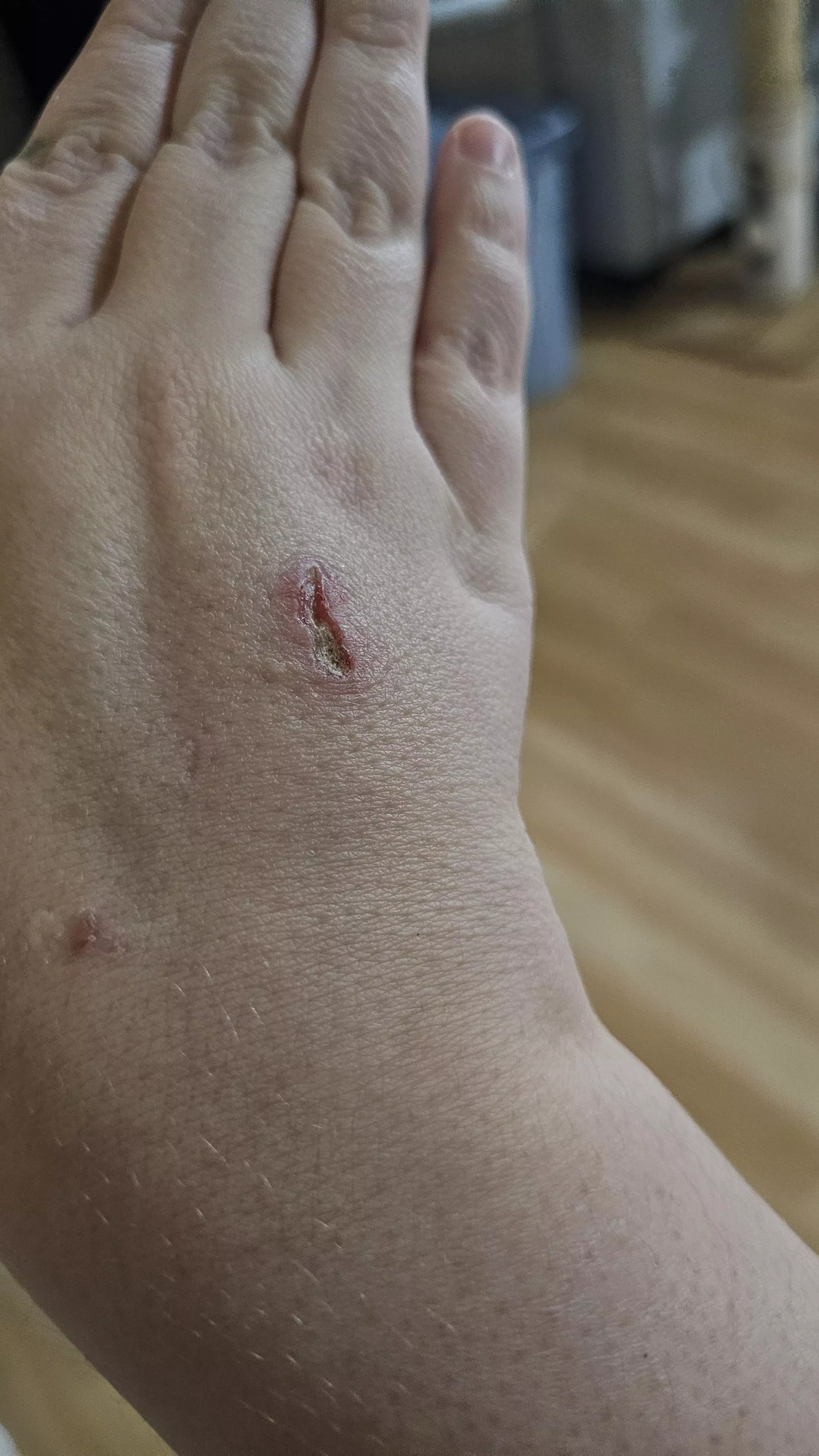 Painful scratch - is this healing?