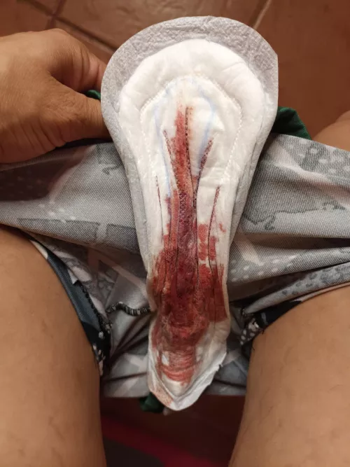 Pass your tongue here