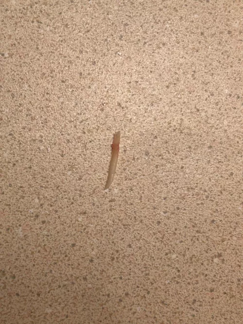 so 15+ years ago i had ingrown toenails. 