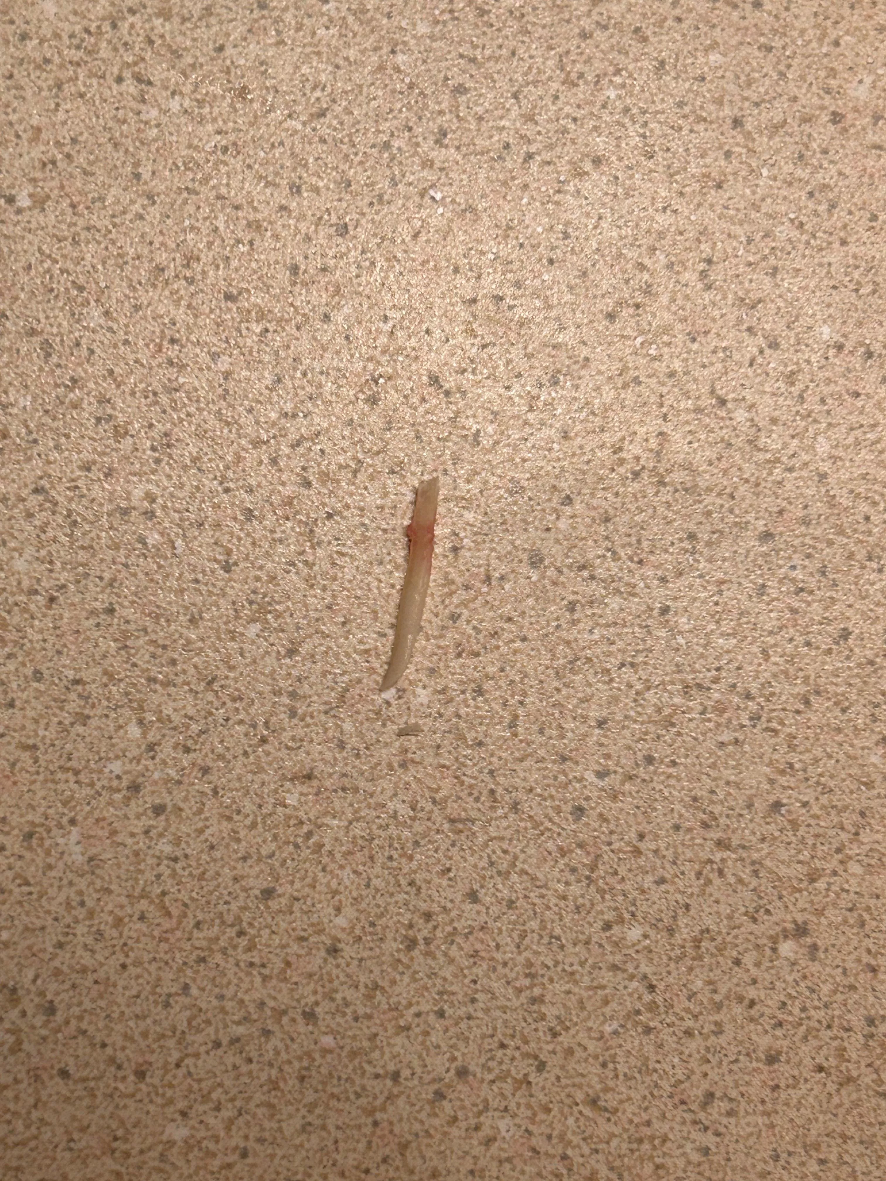 so 15+ years ago i had ingrown toenails. 