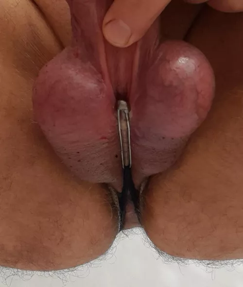 Stiramento del  buco