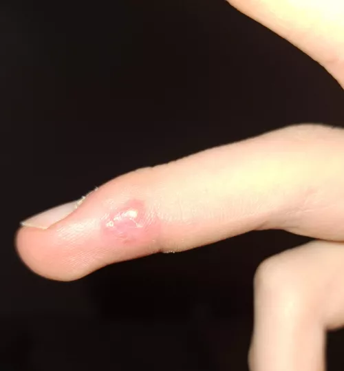 What is this? It doesnt rlly hurt
