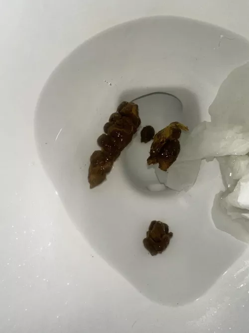 why does it look so weird lol