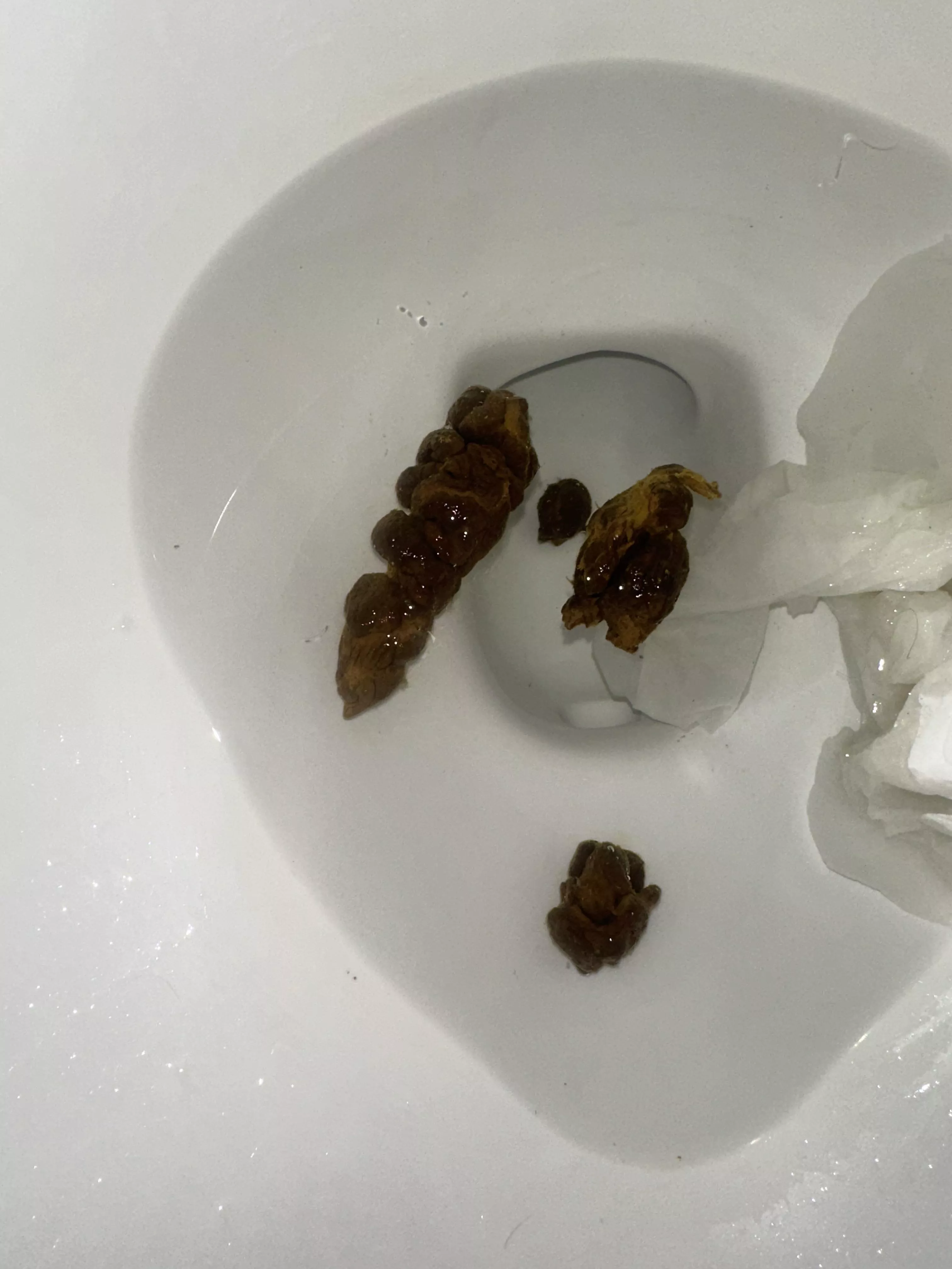 why does it look so weird lol