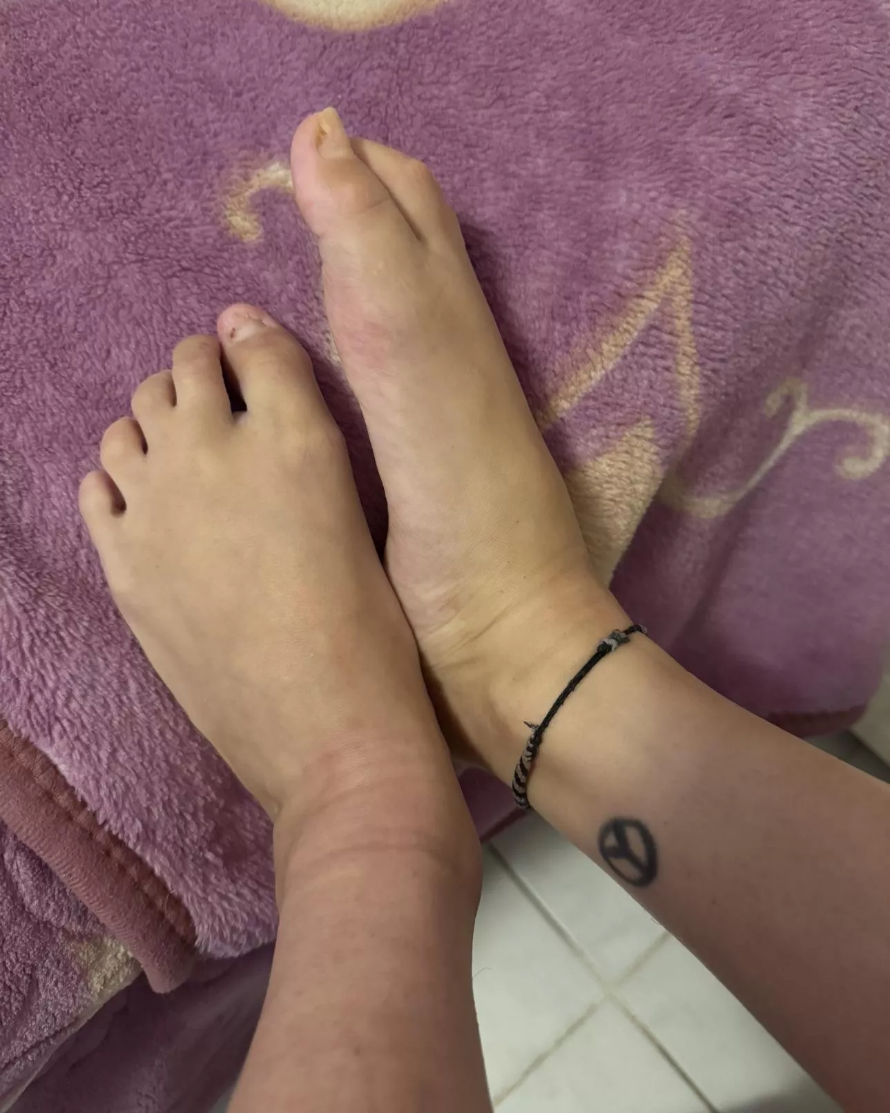 I hope you find the paralyzed feet pleasant. 