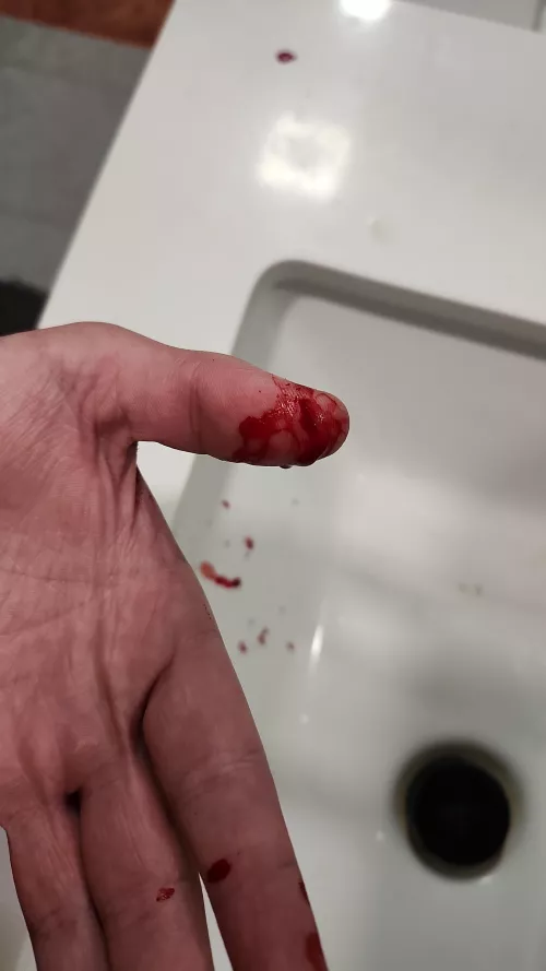 So I was sharpening my knife and it slipped