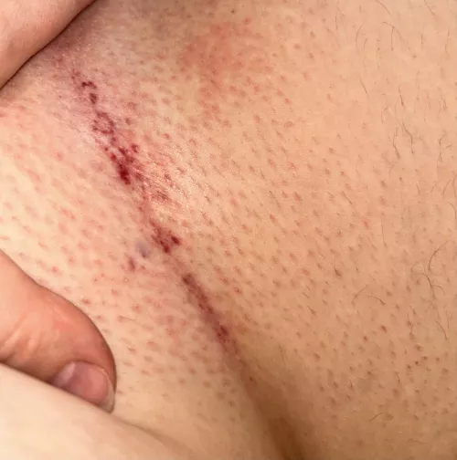 First brazilian, is this normal?