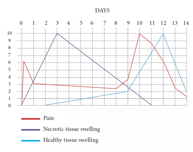 Pain/swelling levels over the first two weeks of my prepex self-cut - details in comments.