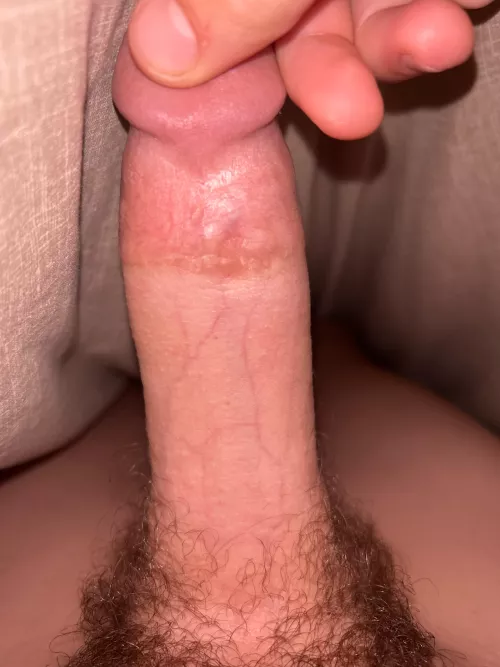 Rate 
