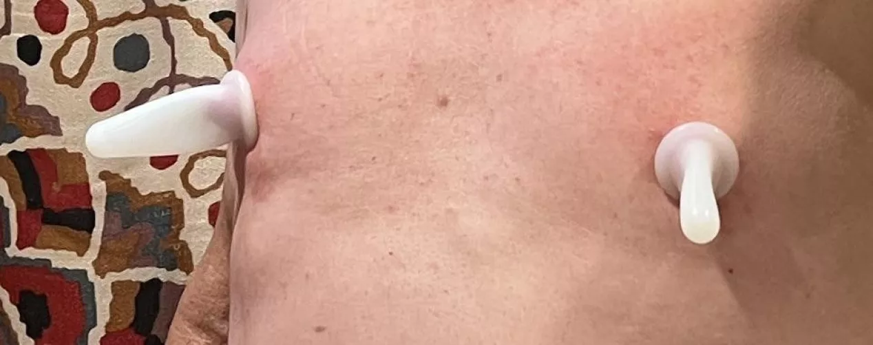 Suction this morning