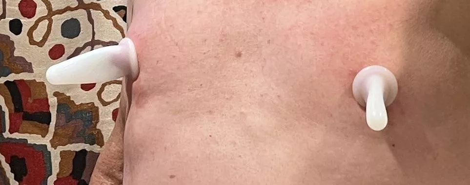 Suction this morning