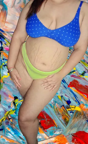 How would you describe my stretch marks? 