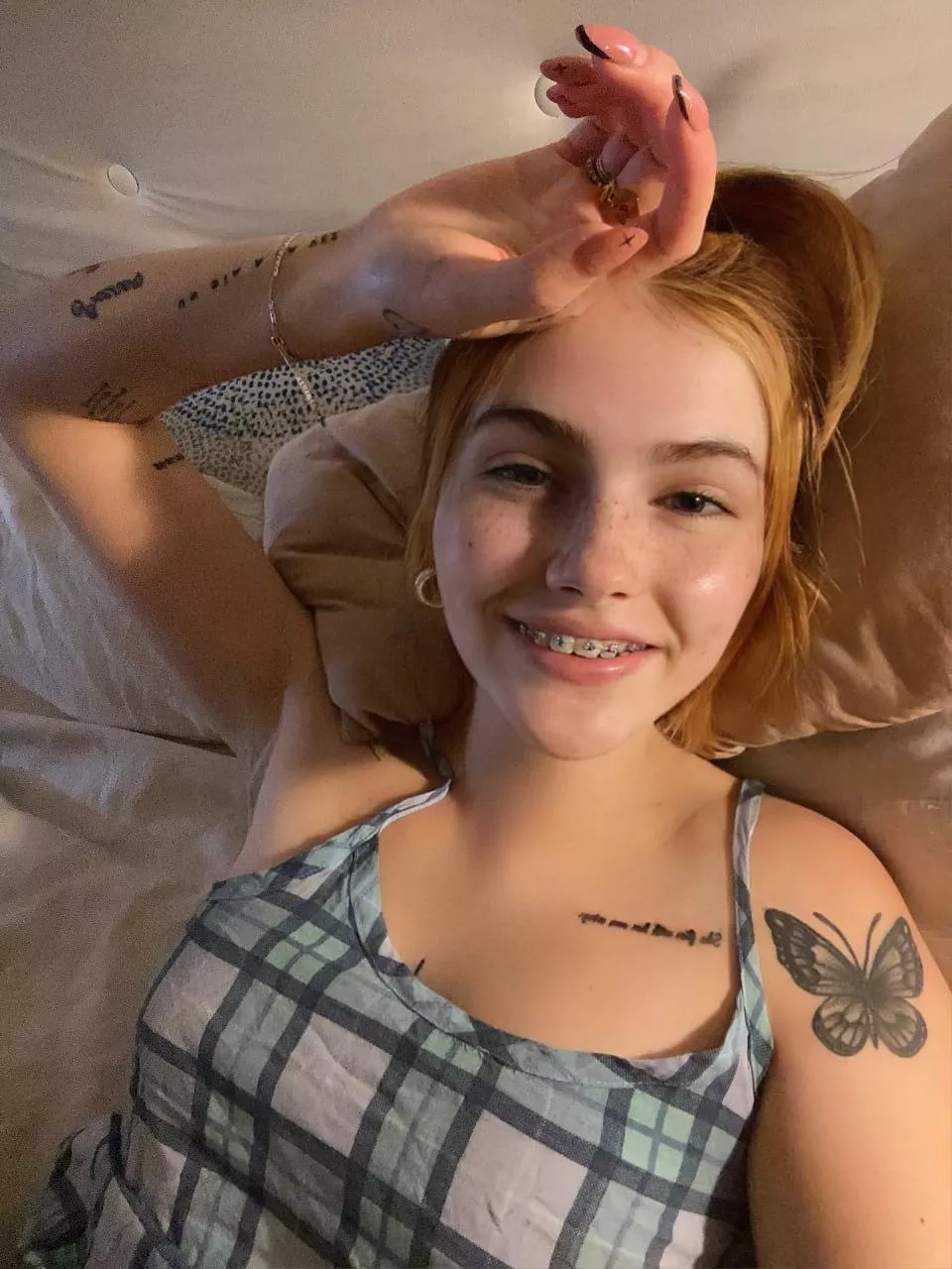 Braces on a teen like me, turn on or off? 🥺