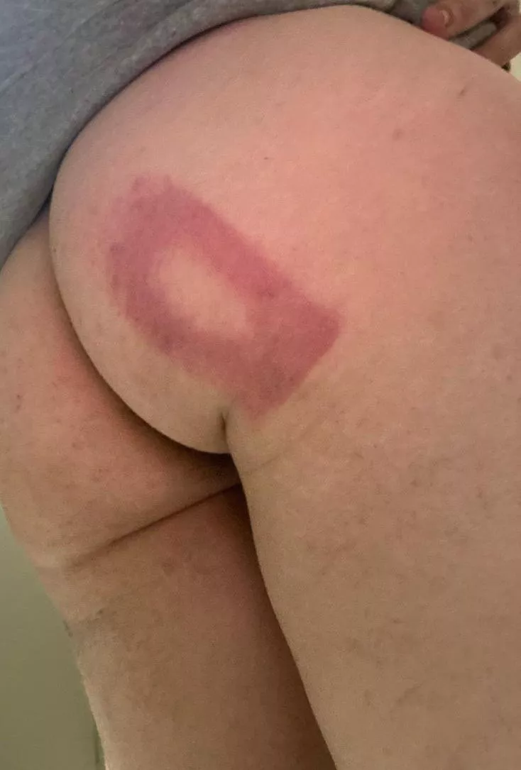 Homemade quarter inch thick rubber strap stings😭