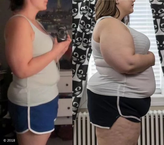 Look at all that cellulite 