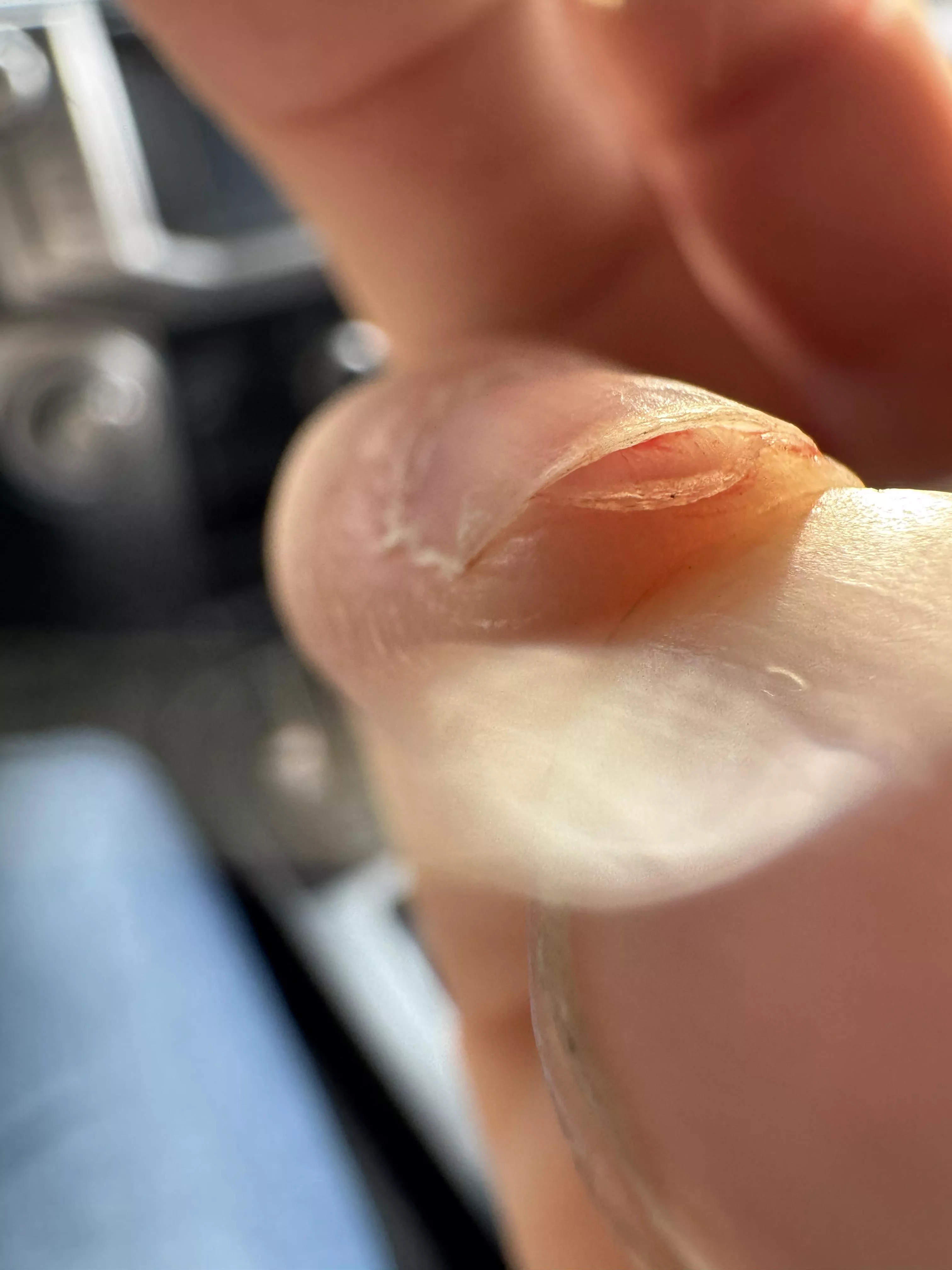 What causes this phenomena? (Nail splitting)