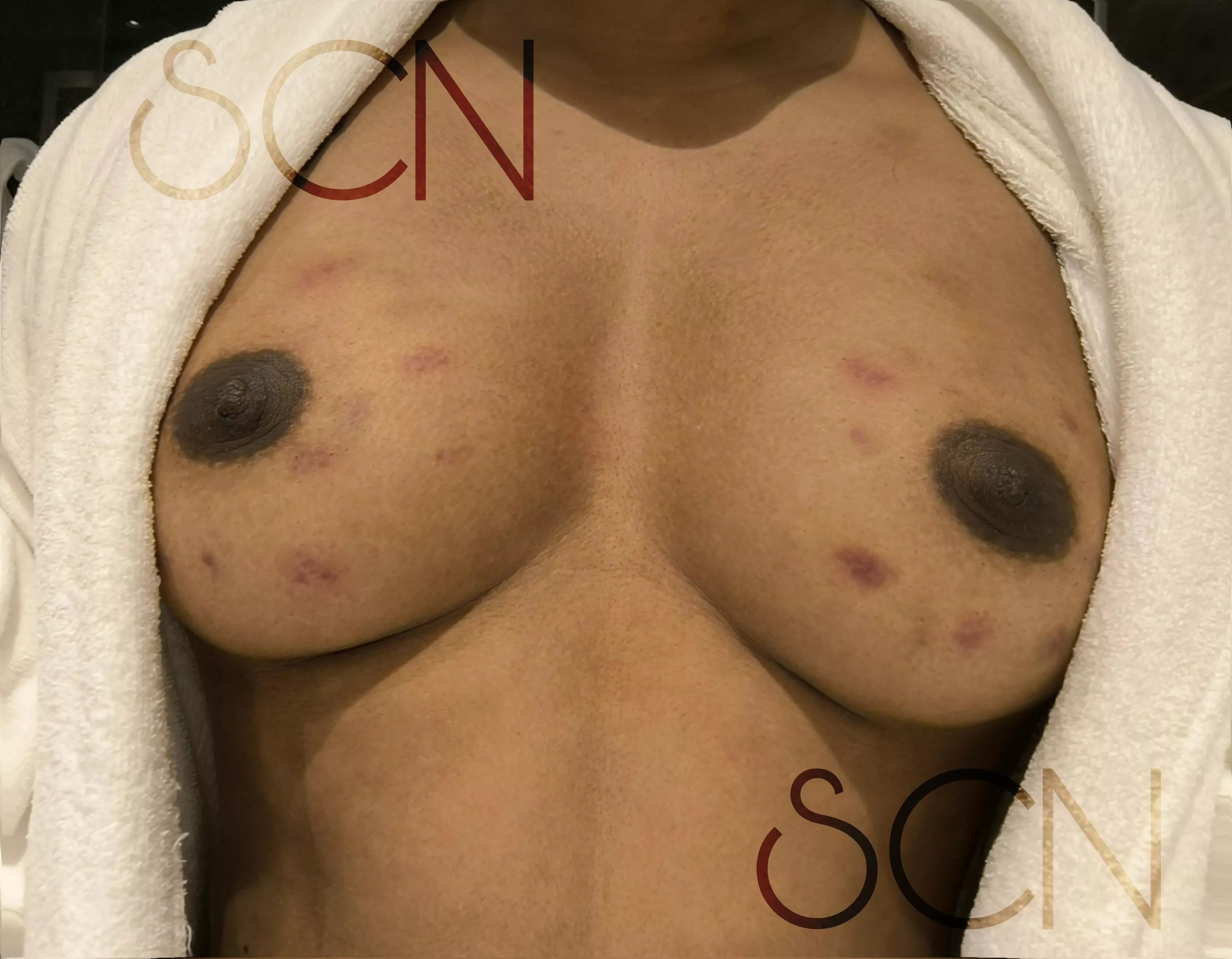 I said I hated my boobs and he did this