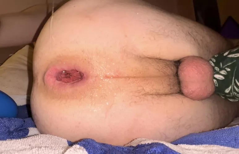 love how my hole looks here