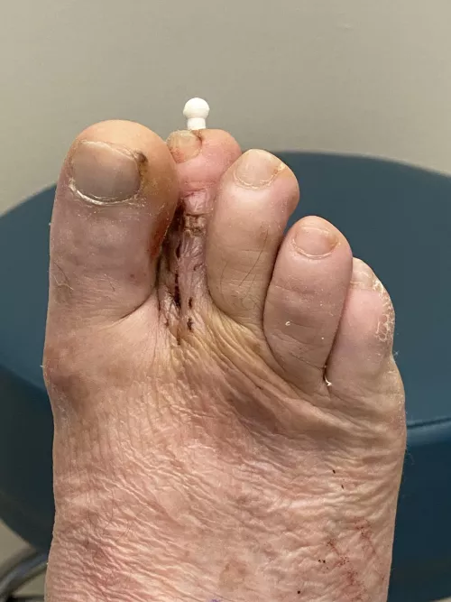 “Put a pin in it” 👨🏻‍🍳