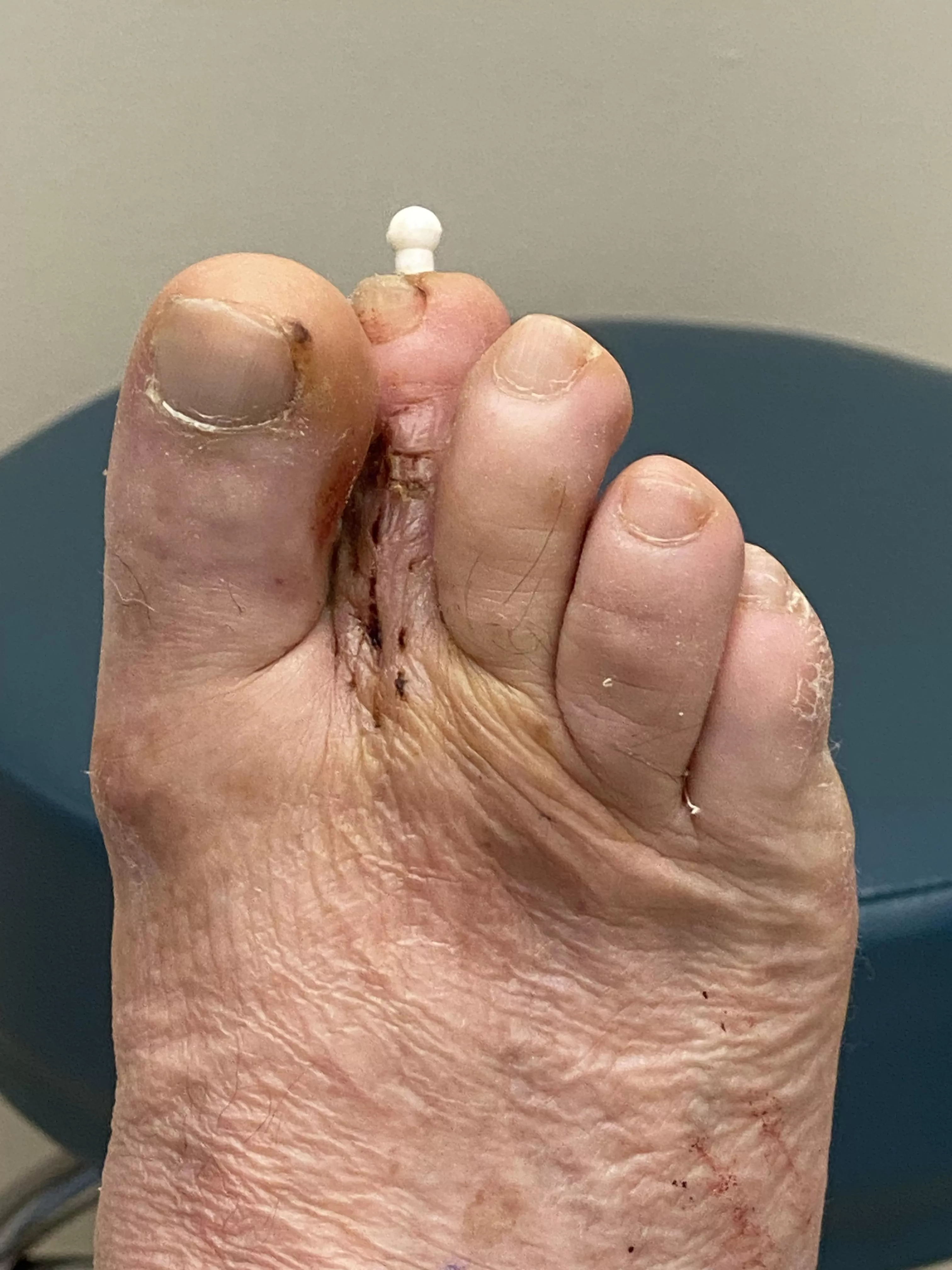 “Put a pin in it” 👨🏻‍🍳