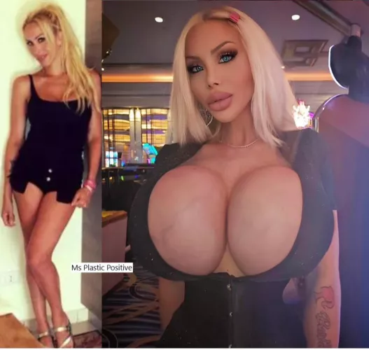 This is the reason why every beautiful girl needs fake tits above 2000c. 