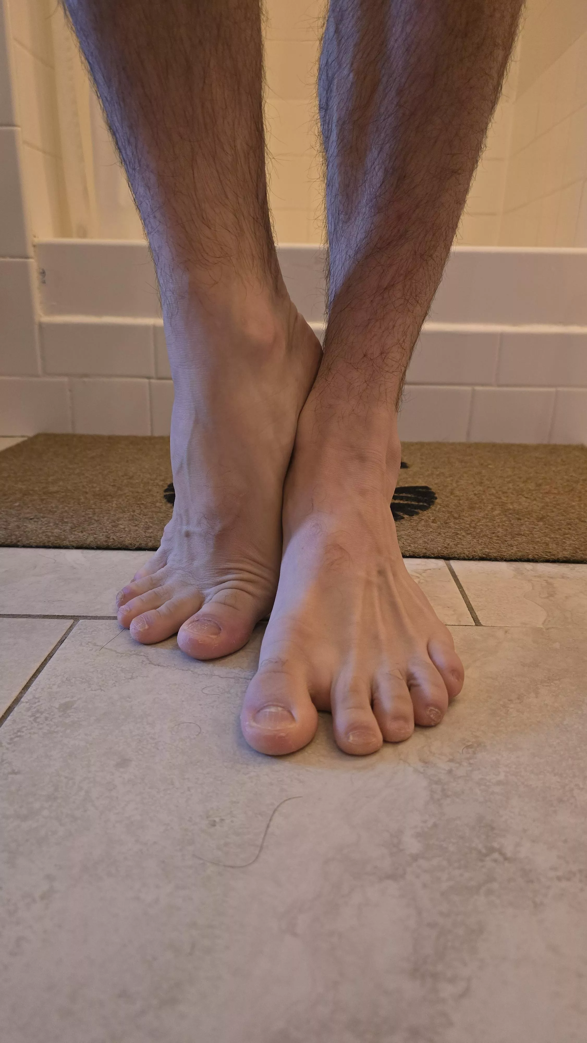 A lot of miles on these feet and it shows. 