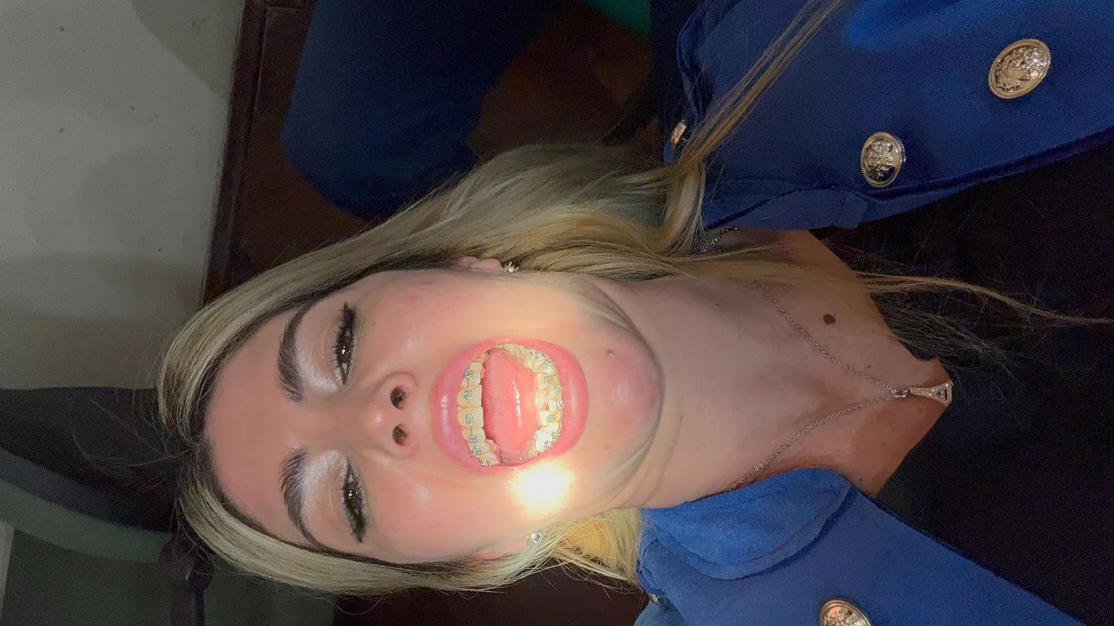 Do you think my dentist gets excited while checking me? 