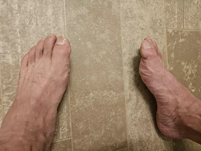 Feet tired from working all day