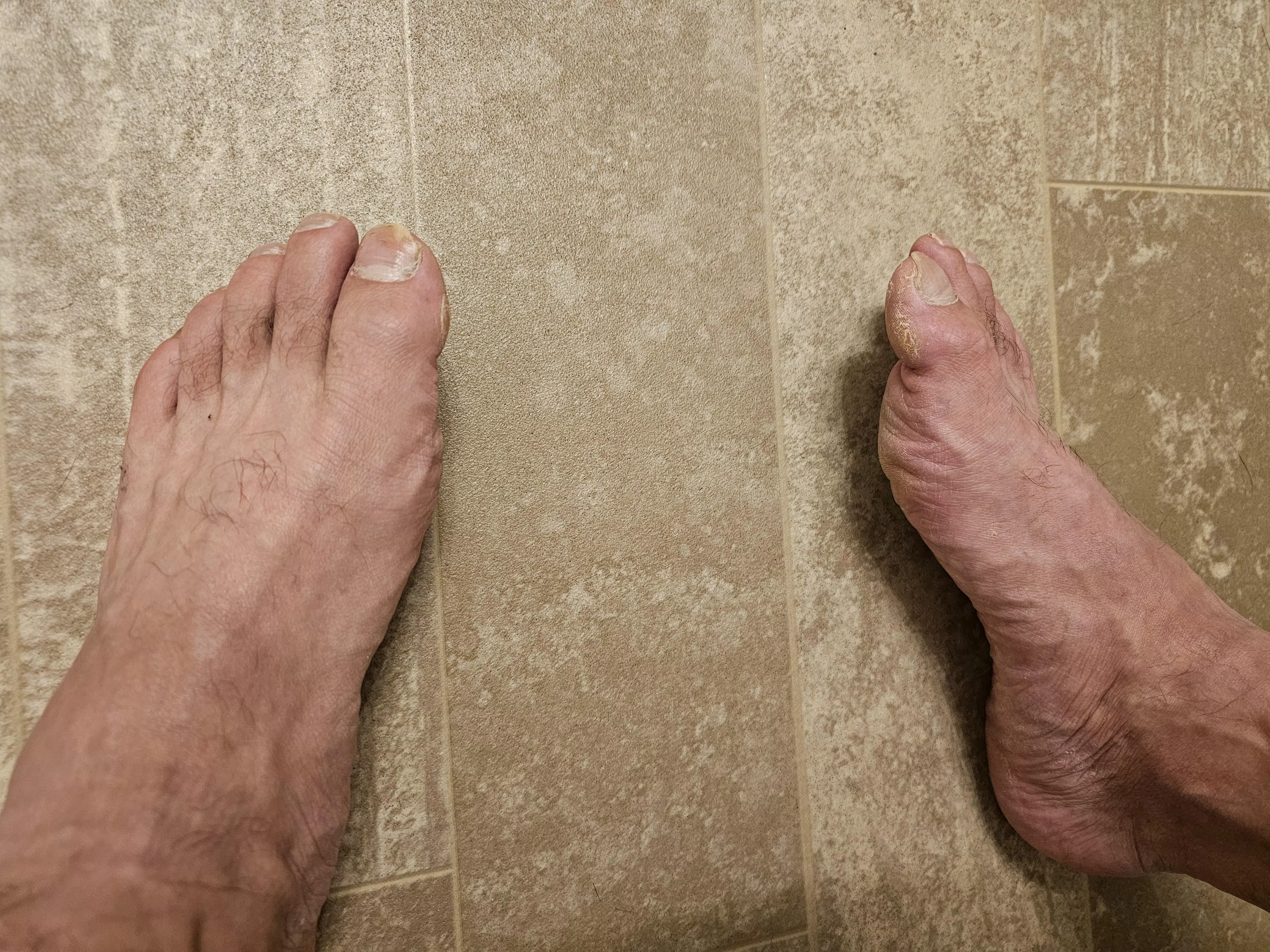 Feet tired from working all day