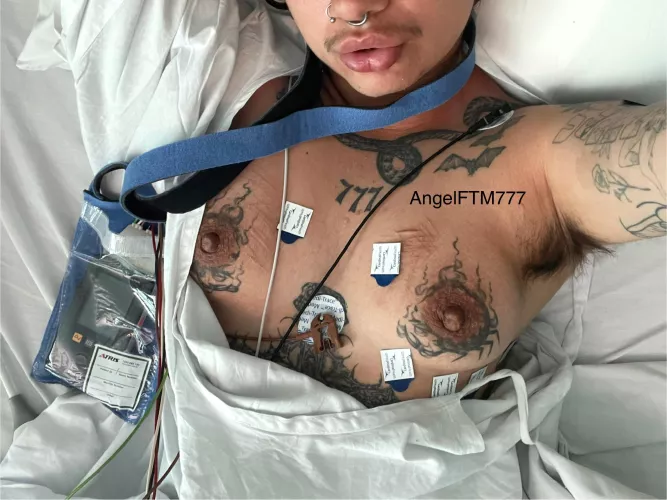 Felt like hospital titty pics belonged here