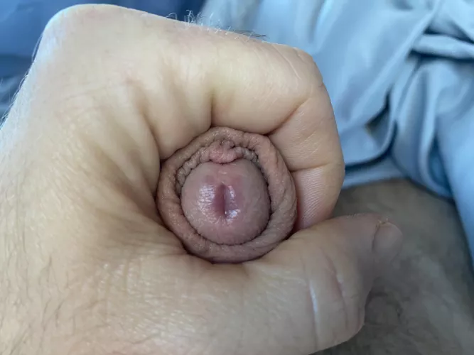 How to fix bunching up?