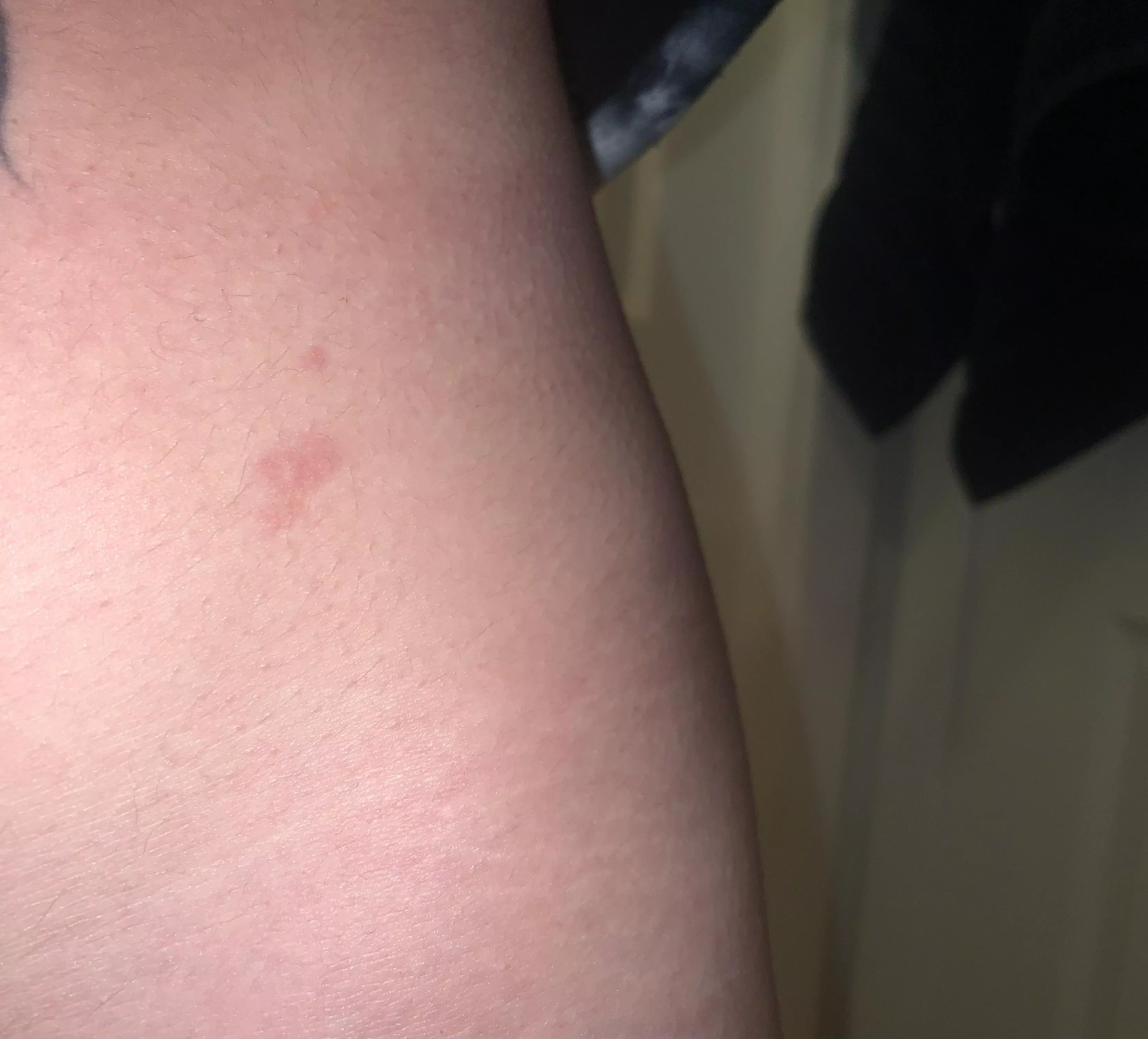 Irritation to clothing? 