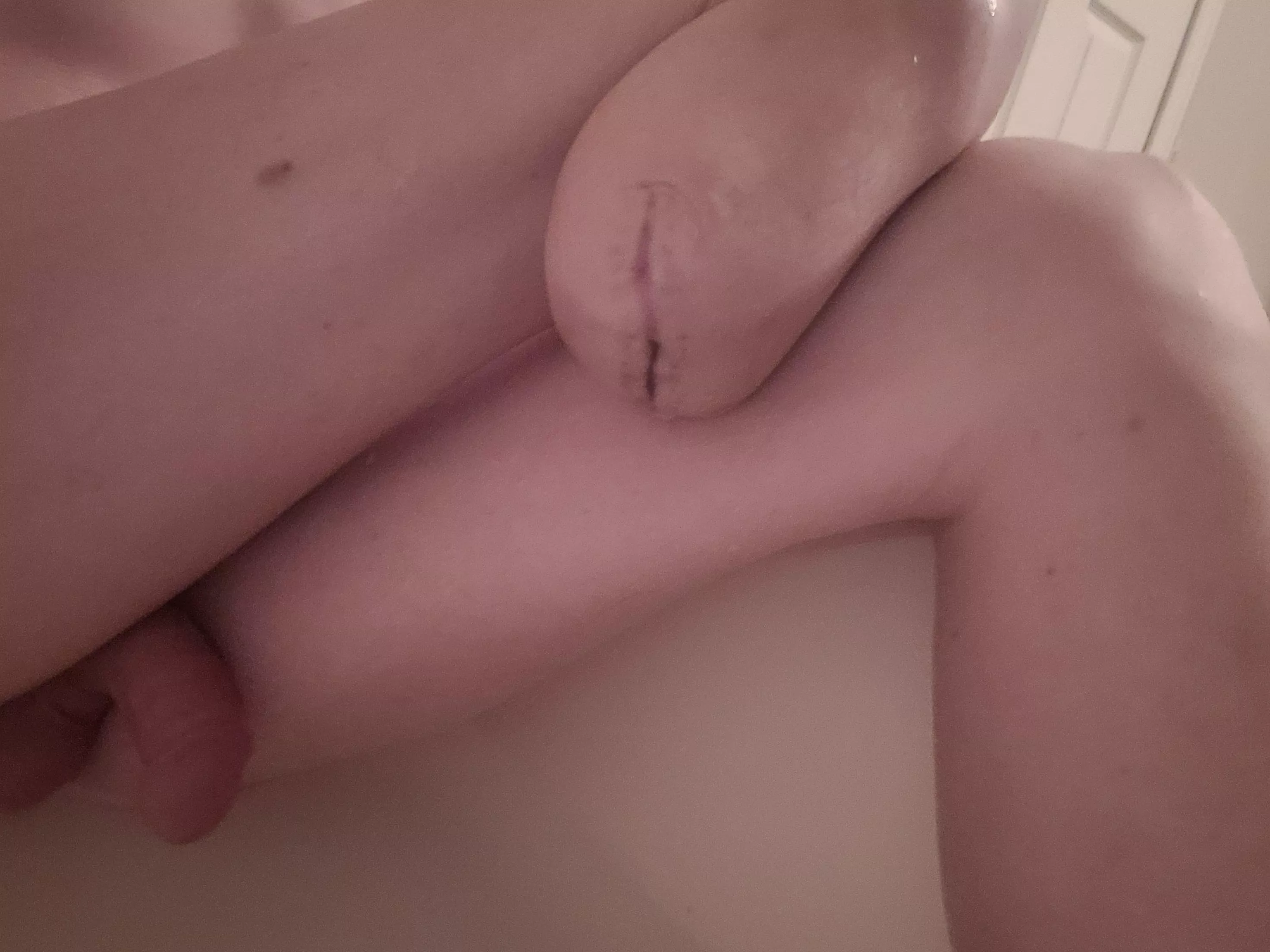 Is my scar okay? 🥺