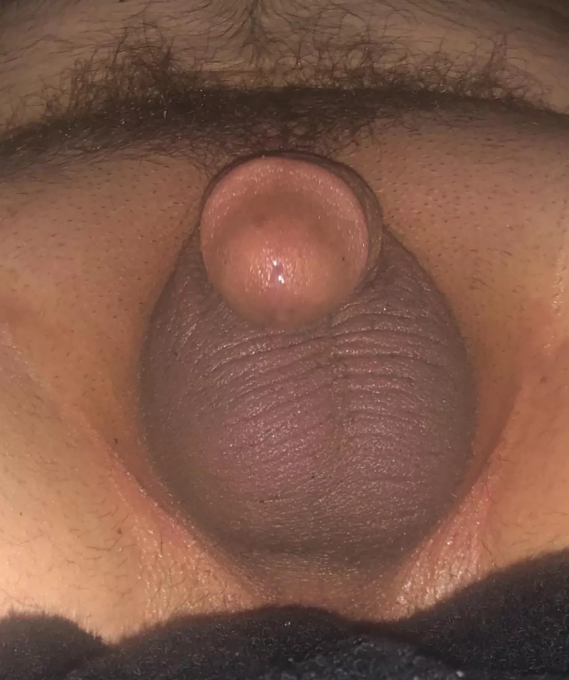 My shrunken penis 