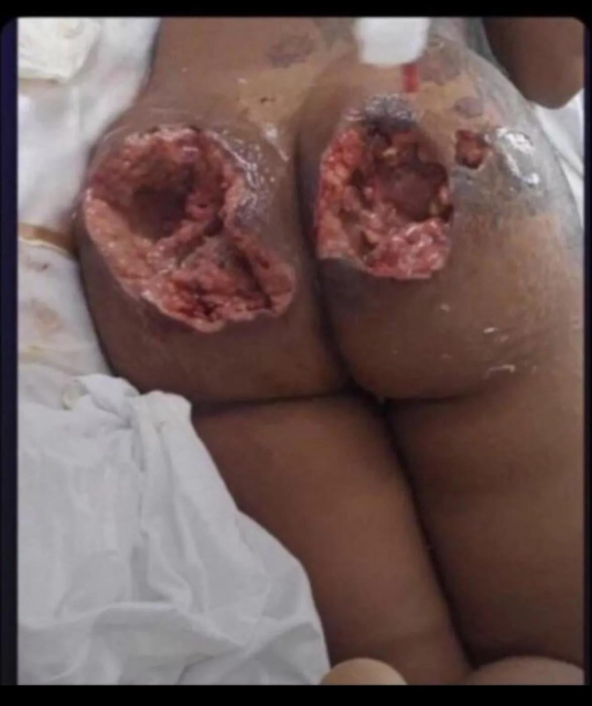 Oh my.. this is scary!