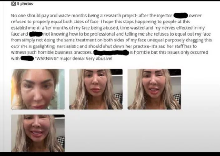 This woman is angry the med spa won’t equally botch the other side 