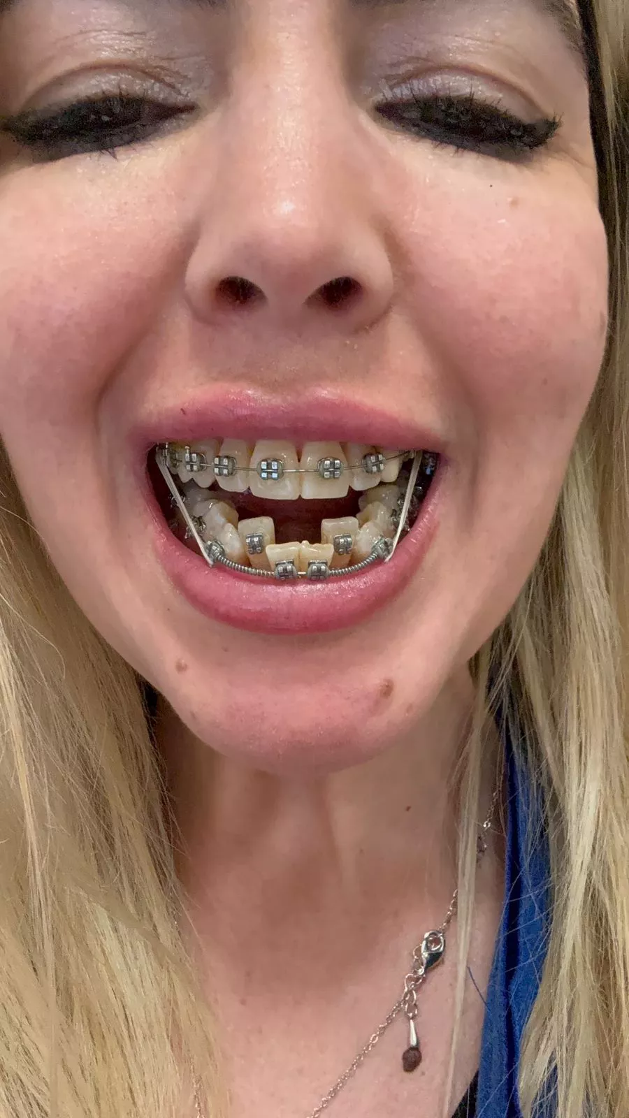 would you let me give you a bj? 