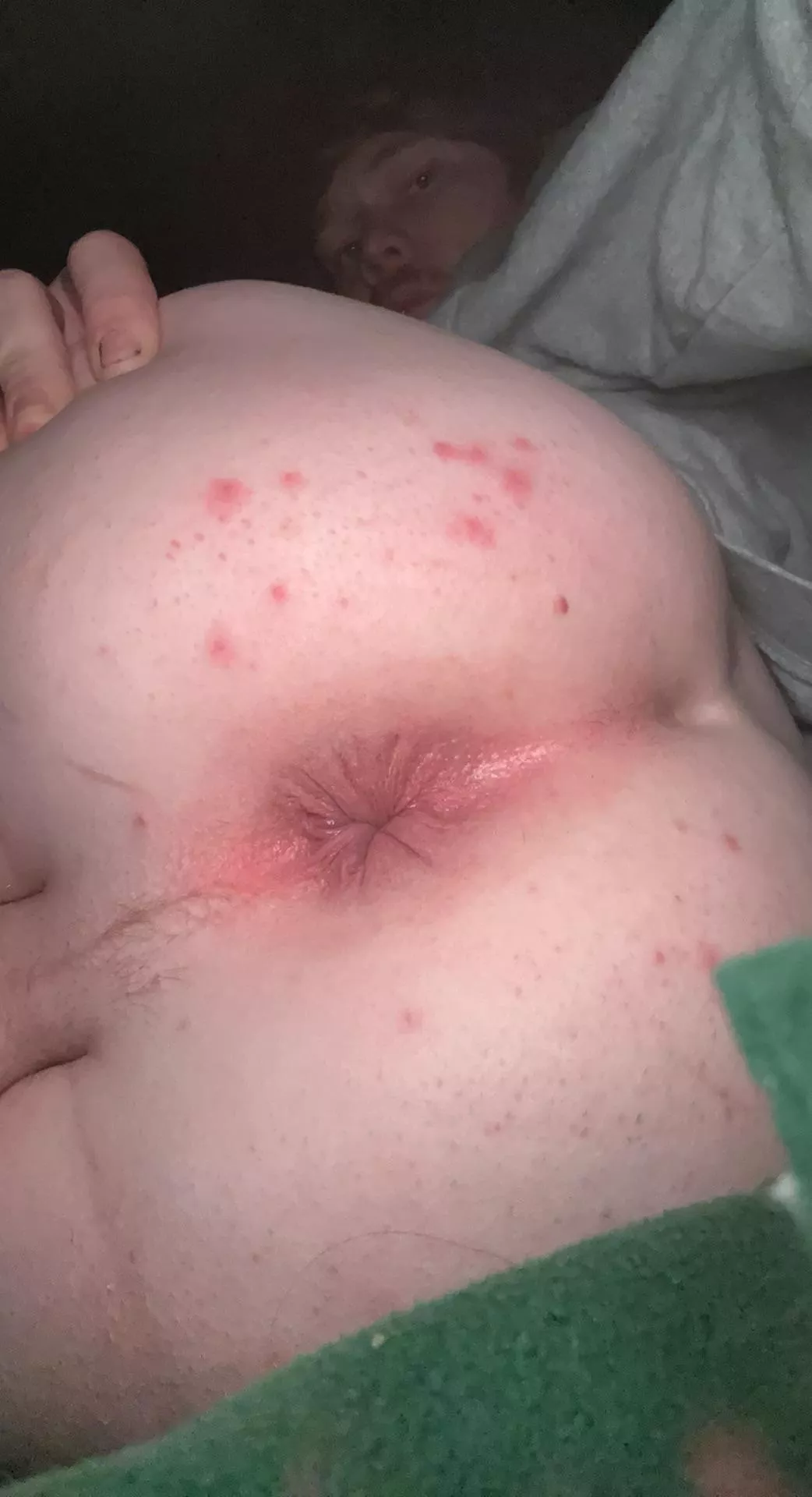 20 bottom want to show off and have my butthole judged