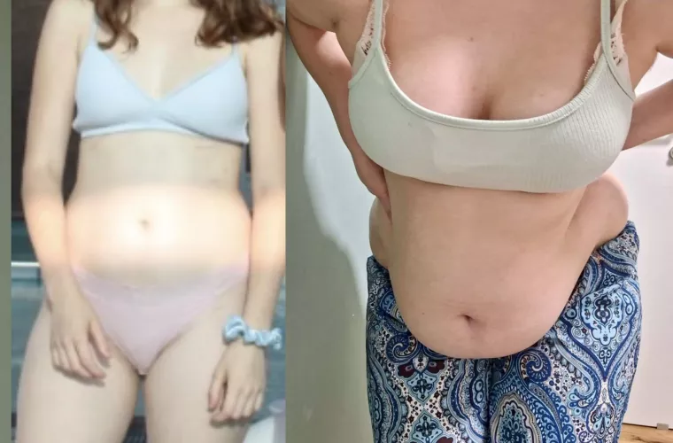 Do you think I can go back, or did I ruin my figure ? 😳🐽