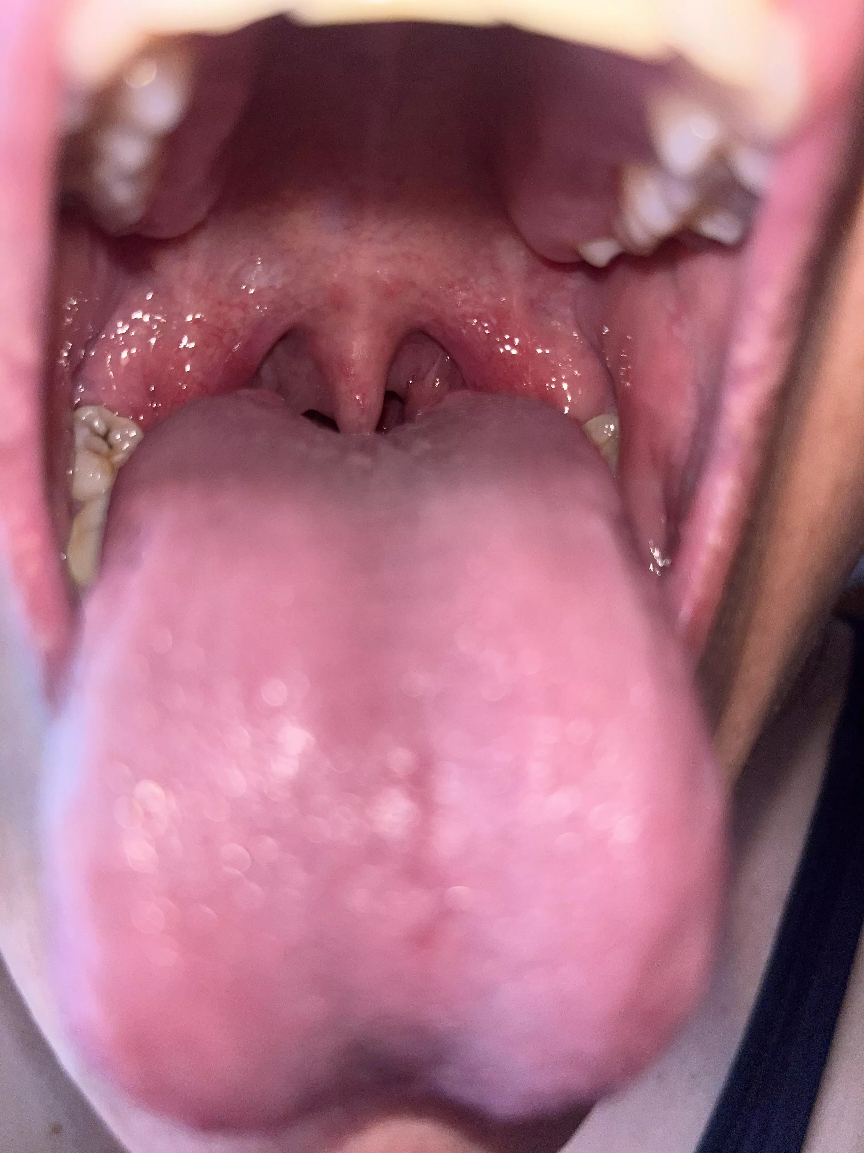 {f} Get in ,You’ll go straight to my stomach