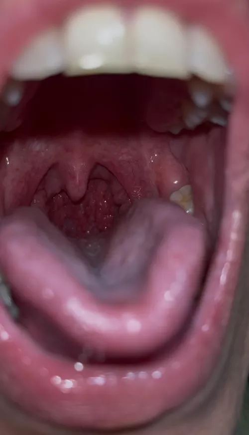 {f} You’re just food for me