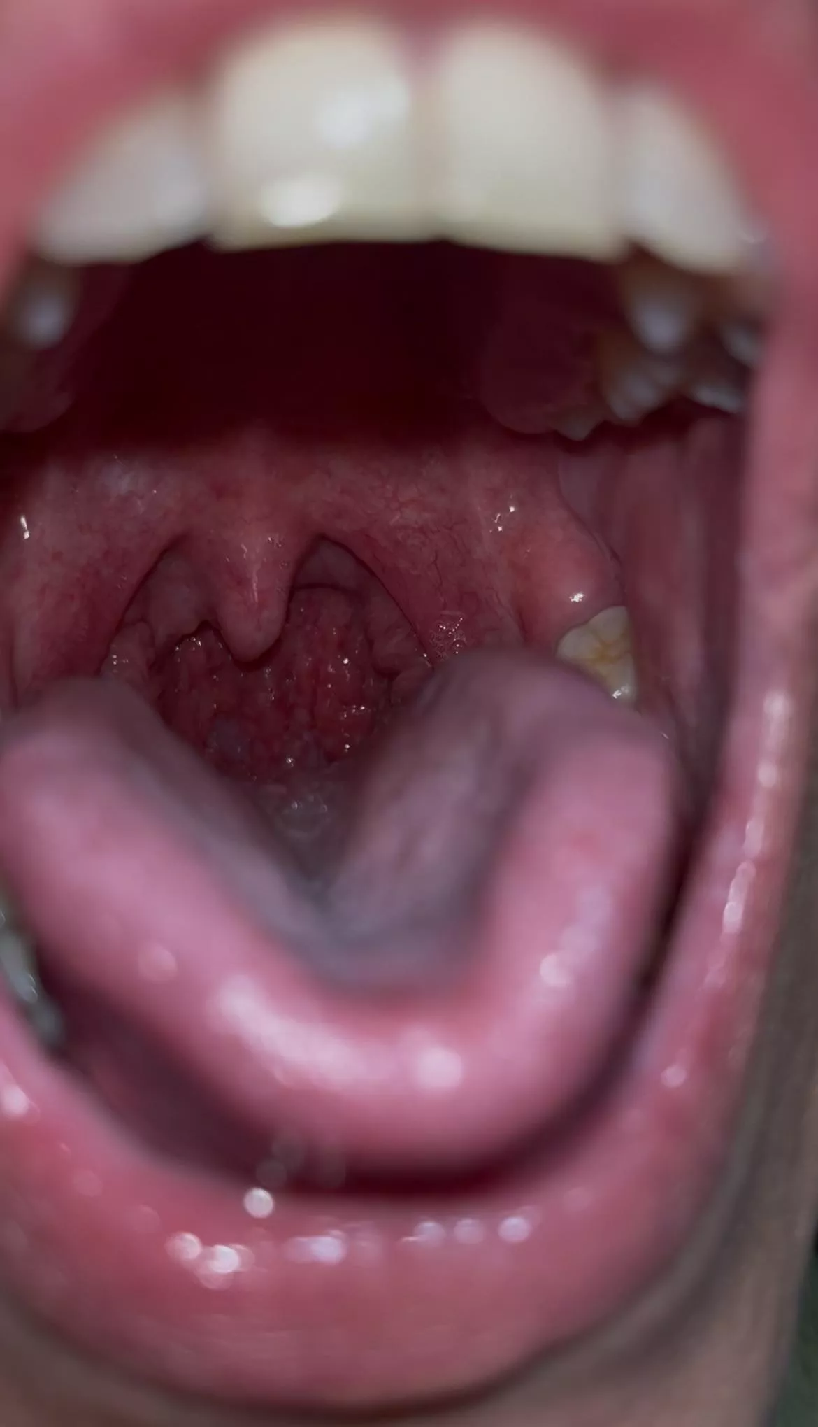 {f} You’re just food for me