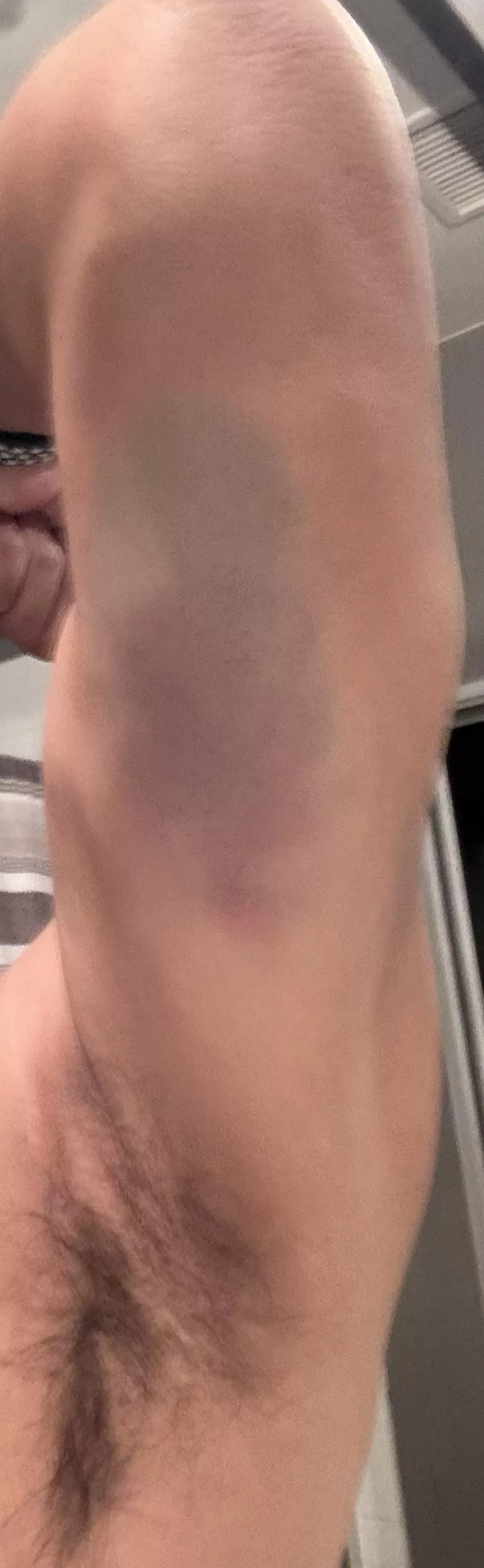 In need of some TLC 👅