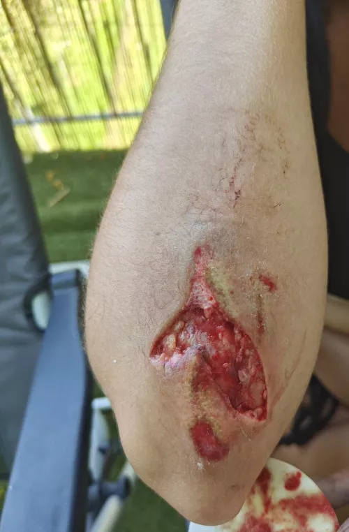 My bicycle wheel got stuck in the tramway track