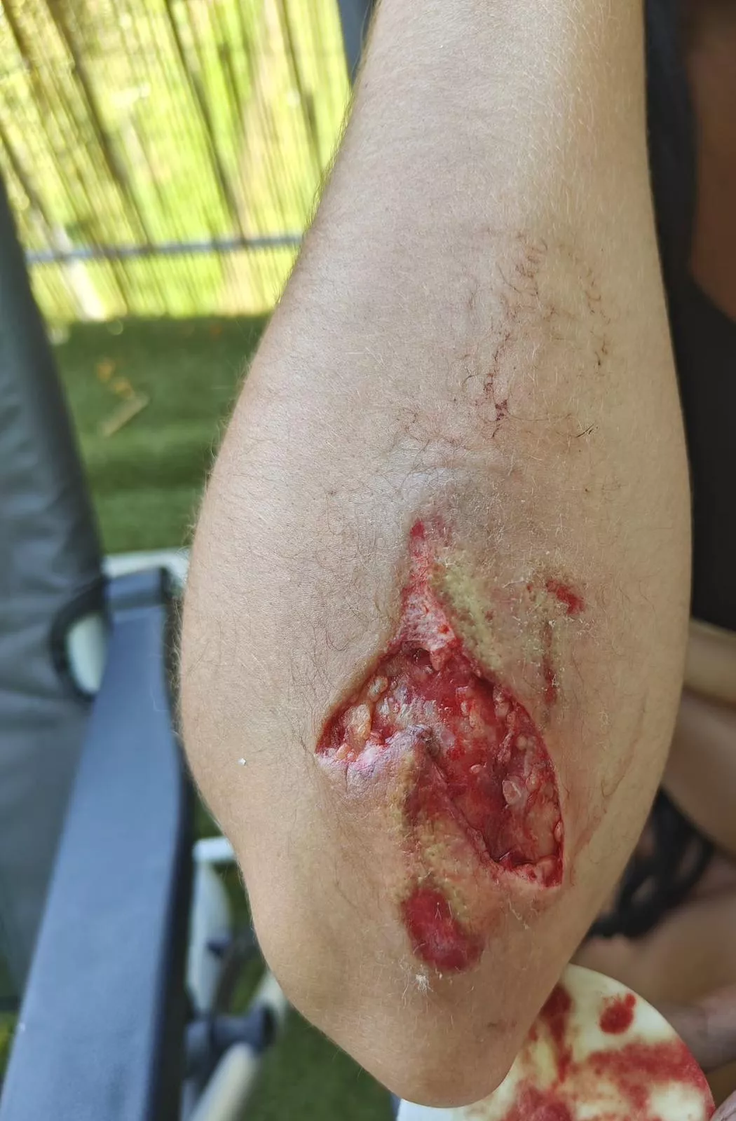 My bicycle wheel got stuck in the tramway track