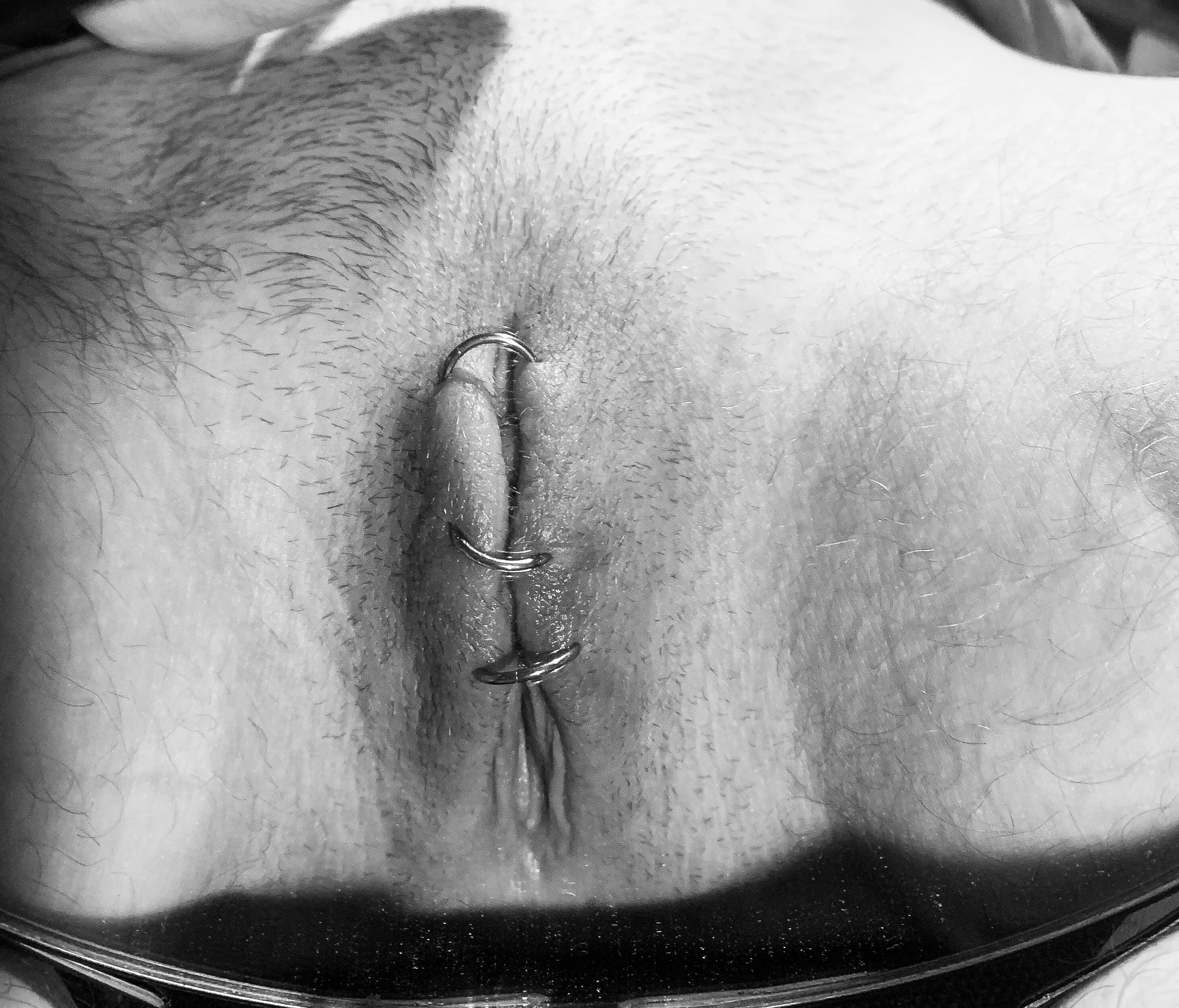 nicely stitched up. no access to clit at all (ftm)